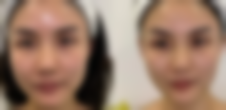 舒慧恺医生顾客实例图片