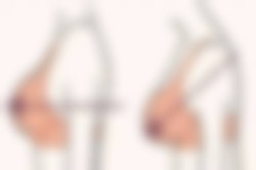 东莞知美整形美容医院价格表