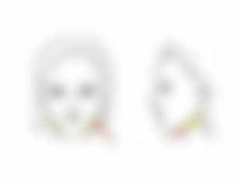 割过的双眼皮有疤痕可以修复吗，疤痕修复方法+最佳时间+全国十大医院推荐