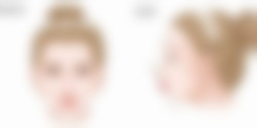 割过的双眼皮疤痕修复方法大盘点