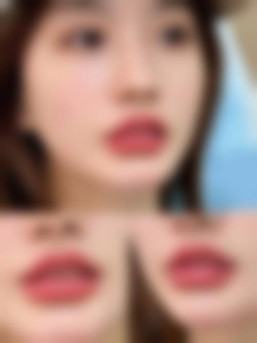 龙文碧湖新医美医疗美容诊所价格表