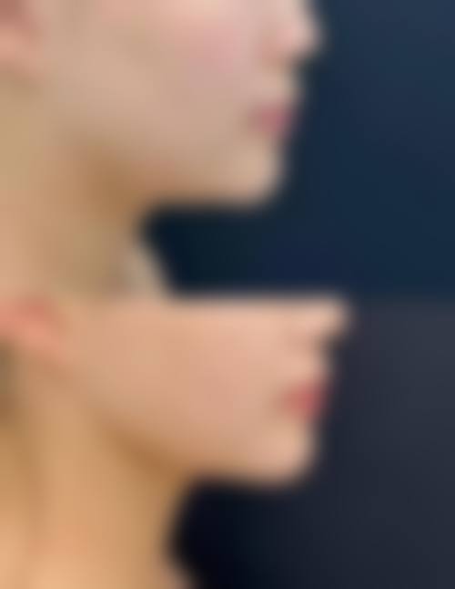 南宁余德庆医疗美容外科诊所可靠吗