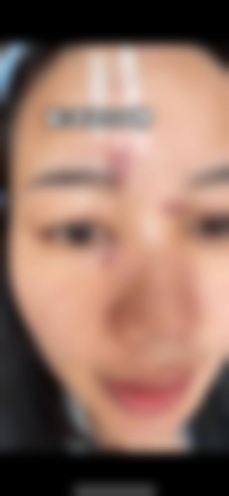 安庆市第一人民医院整形美容科真实患者口碑评价