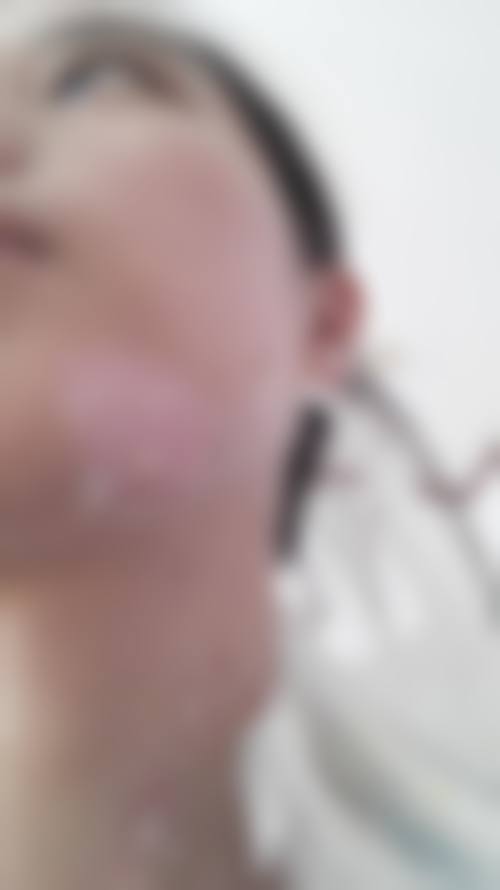 上海美尔雅医疗美容诊所怎么样，价格表