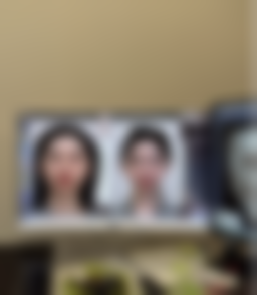 身体肥胖抽脂的可行性与条件