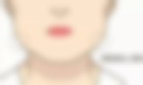 疤痕变白了怎样修复肉色素沉淀——兰州五洲医院的治疗方案及价格参考