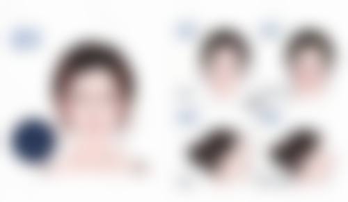 疤痕变白了怎样修复肉色素沉淀——治疗过程中的注意事项