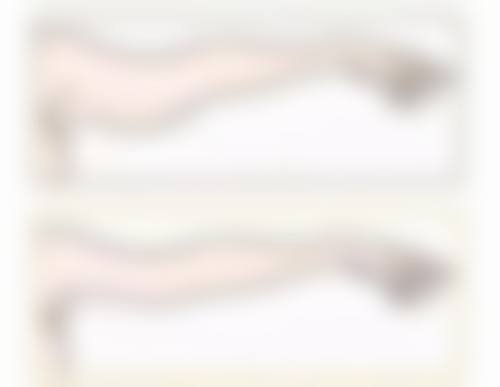 痘印白色疤痕能去除吗？激光治疗+药物护理双管齐下，费用低至300元起