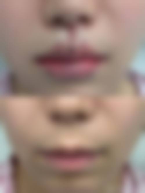 tt整形外科正规吗