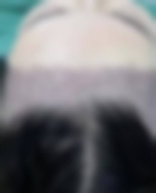 闫小林医生做手术价格