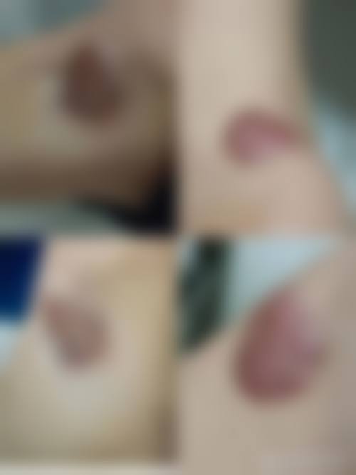 延吉天美保健整形美容门诊部怎么样，价格表