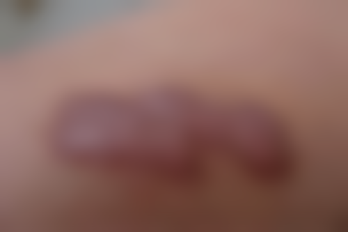 怎么预约杭州悦可医疗美容诊所熊员平——预约注意事项