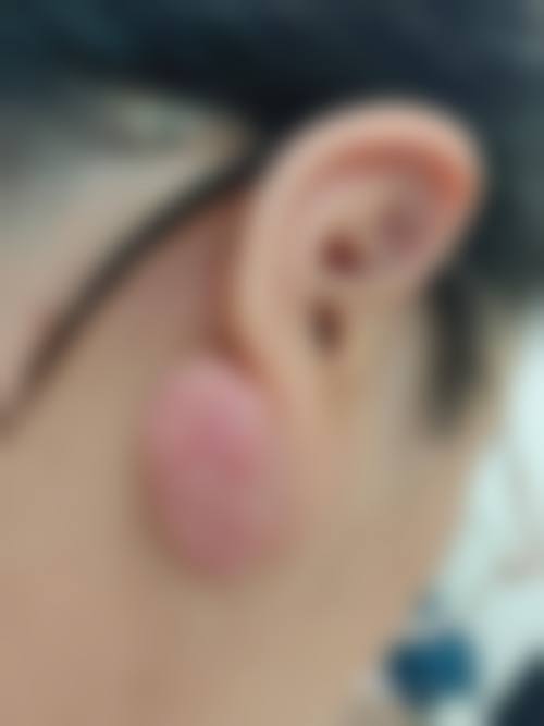 重庆新桥医院整形美容科项目特色