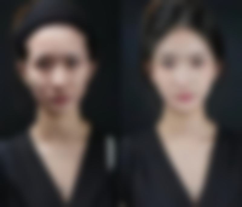 疤痕体质增生怎么治疗之医院选择：专精机构评判的关键指标