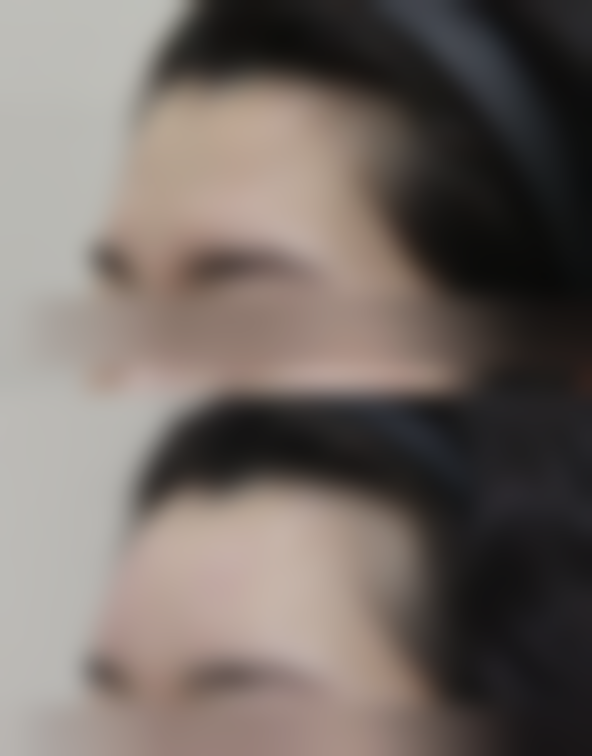 郑州郑东何氏医疗美容诊所更擅长什么手术