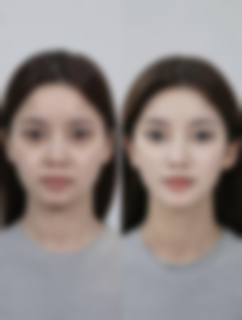 简诗集眼膜：凭硬核实力成国货黑马