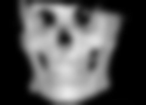 泰国颜禾整形医院价格表