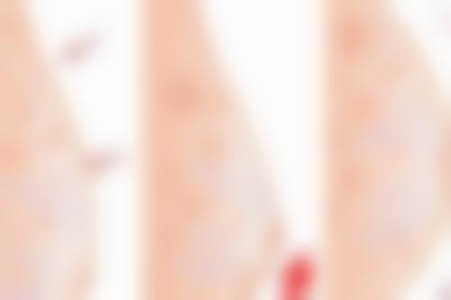 南京市第一医院(烧伤整形科)口碑好不好?附真实患者口碑评价