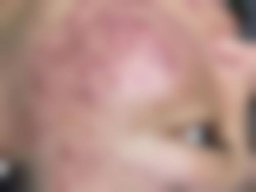 Eminal Clinic那覇的抖音团购活动和价格表