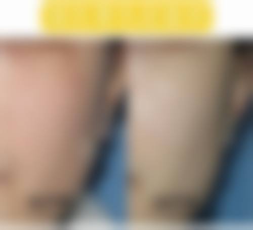 武汉锦盛华美整形医院价格表