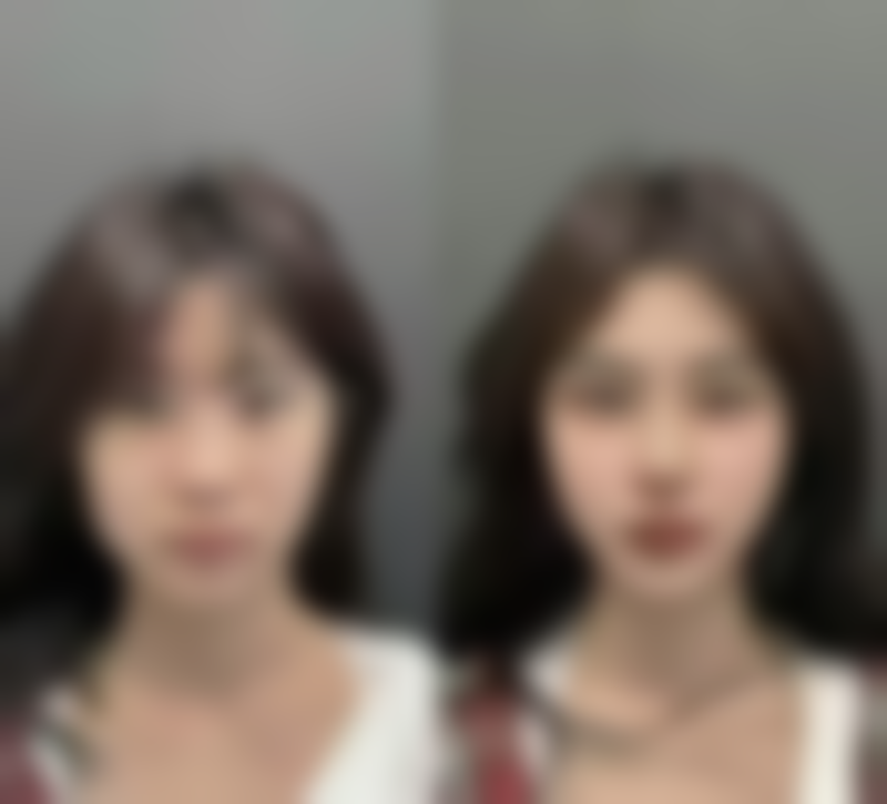 泰国颜禾整形医院项目特色