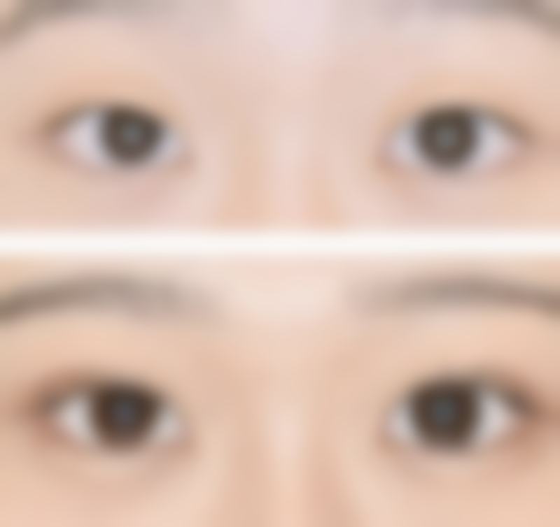 惠州伊生美整形医院怎么样，口碑评价如何？