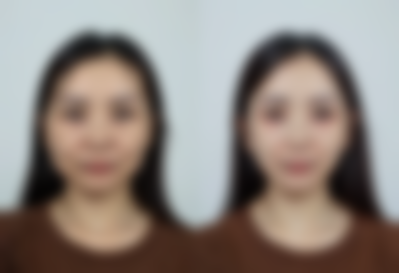 韩国朴宰宇整形外科医院项目特色