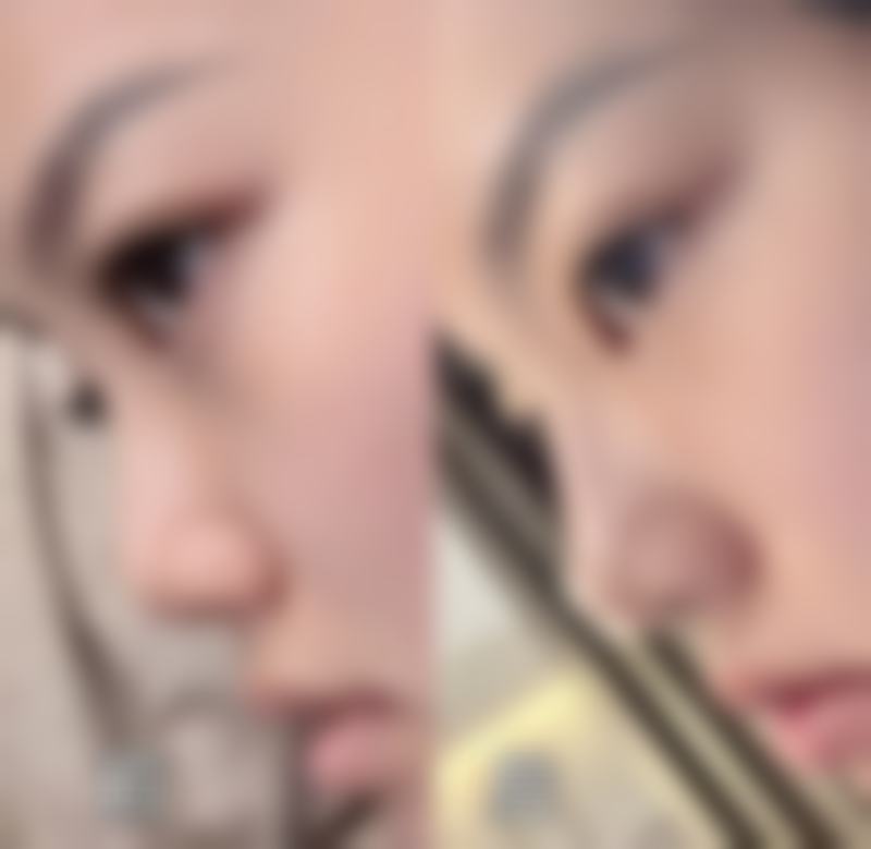 上海德琳医疗美容医院【乐威增粗项目介绍+6500】优势在哪？