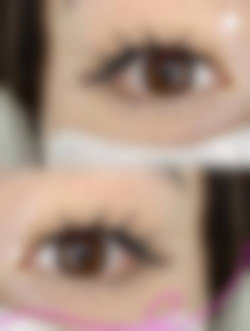 广州大海植发医院医生情况,影响植发怎么样?