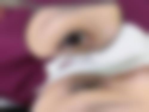 七、柳州新生天美（瑞尔）医疗美容医院怎么样口碑好不好？附真实患者口碑评价