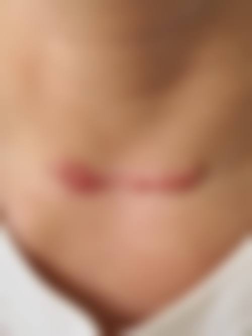 黄雷医生简介口碑如何