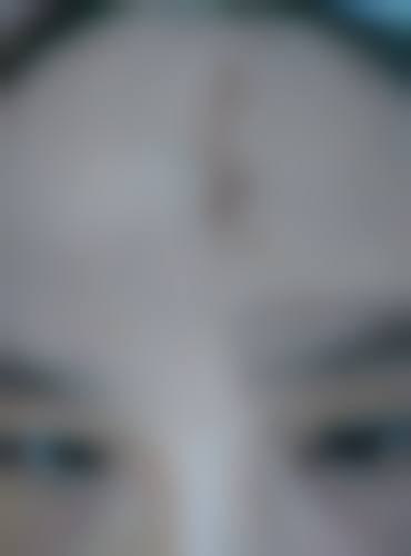 黄雷医生简介项目优势