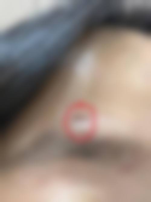 黄雷医生简介顾客实例图片