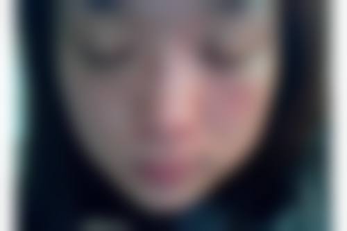 河源曙光整形医院口碑好不好？附真实患者口碑评价：良好口碑见证，顾客满意度高