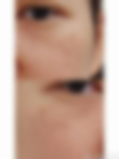 西安允朵整形医院口碑好不好?附真实患者口碑评价