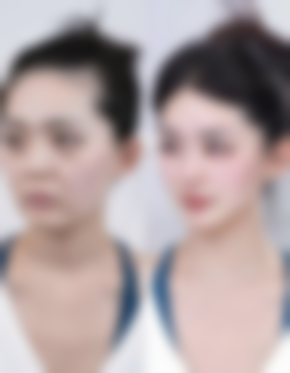 河源曙光整形医院怎么样，口碑评价如何：高口碑获认可，服务成效双优