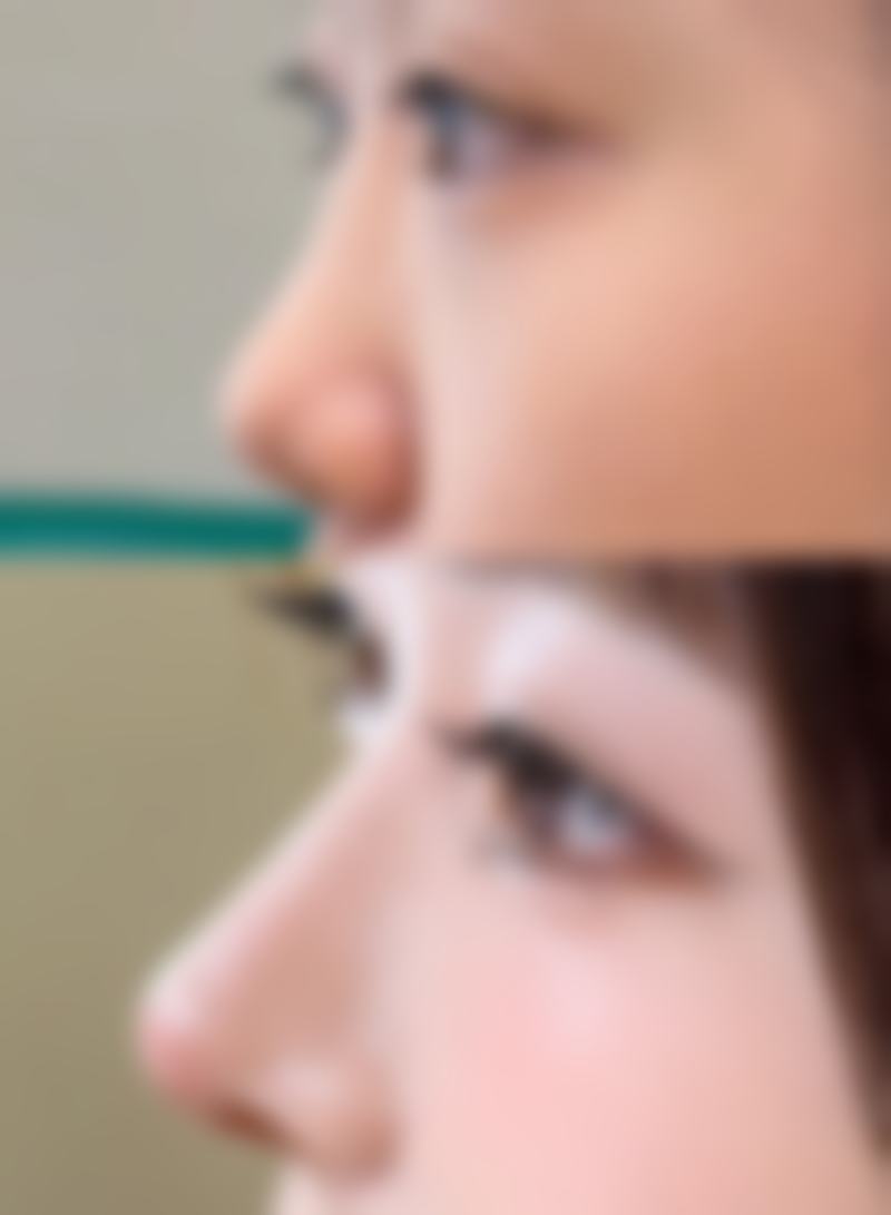 台州媚焕整形医疗美容门诊部更擅长什么