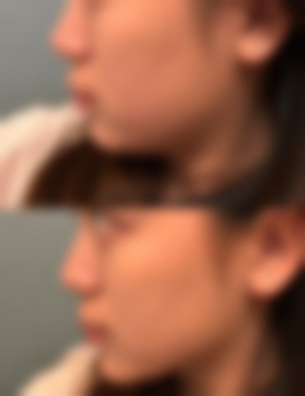 青岛诺菲医疗美容诊所怎么挂号，地址在哪儿