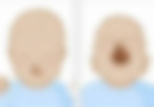 衢州柯城馨丽莱整形医院口碑评价如何