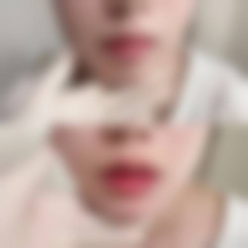 韩国巴诺巴奇整形外科医院价格表