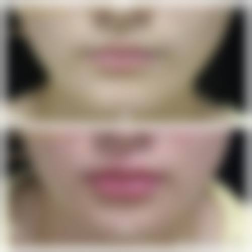 枣庄西子华铭整形医院怎么样之项目特色