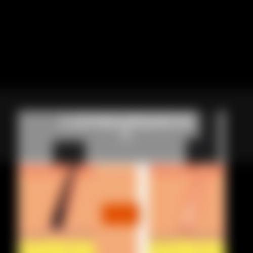 西安精锐植发医疗美容诊所评价