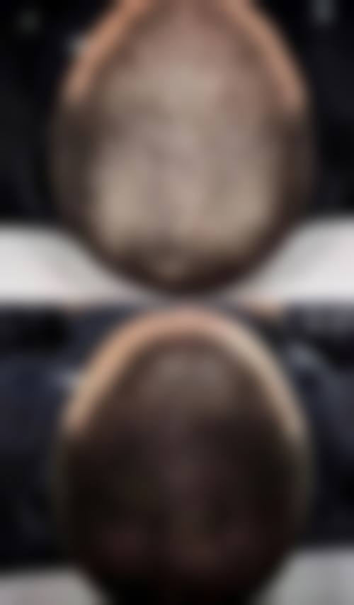 韩国巴诺巴奇整形外科医院口碑好不好