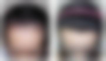 西安精锐植发医疗美容诊所更擅长什么手术