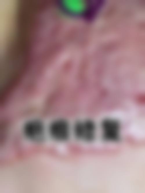 金志勋医生怎么挂号指南