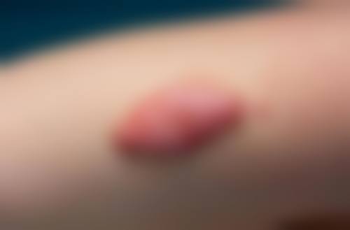 沈炳家医生简介顾客实例图片