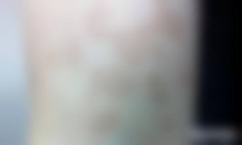 北京美杜莎(禾力康)医疗美容门诊部更擅长什么