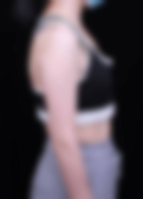 成都武侯美熹医疗美容抖音团购活动及价格表