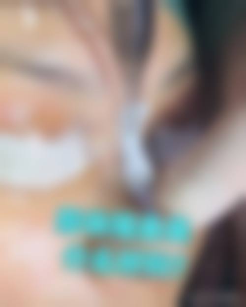 韩国巴诺巴奇整形外科医院口碑评价