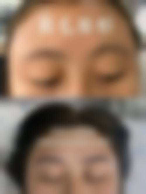 童晓玮医生项目优势情况